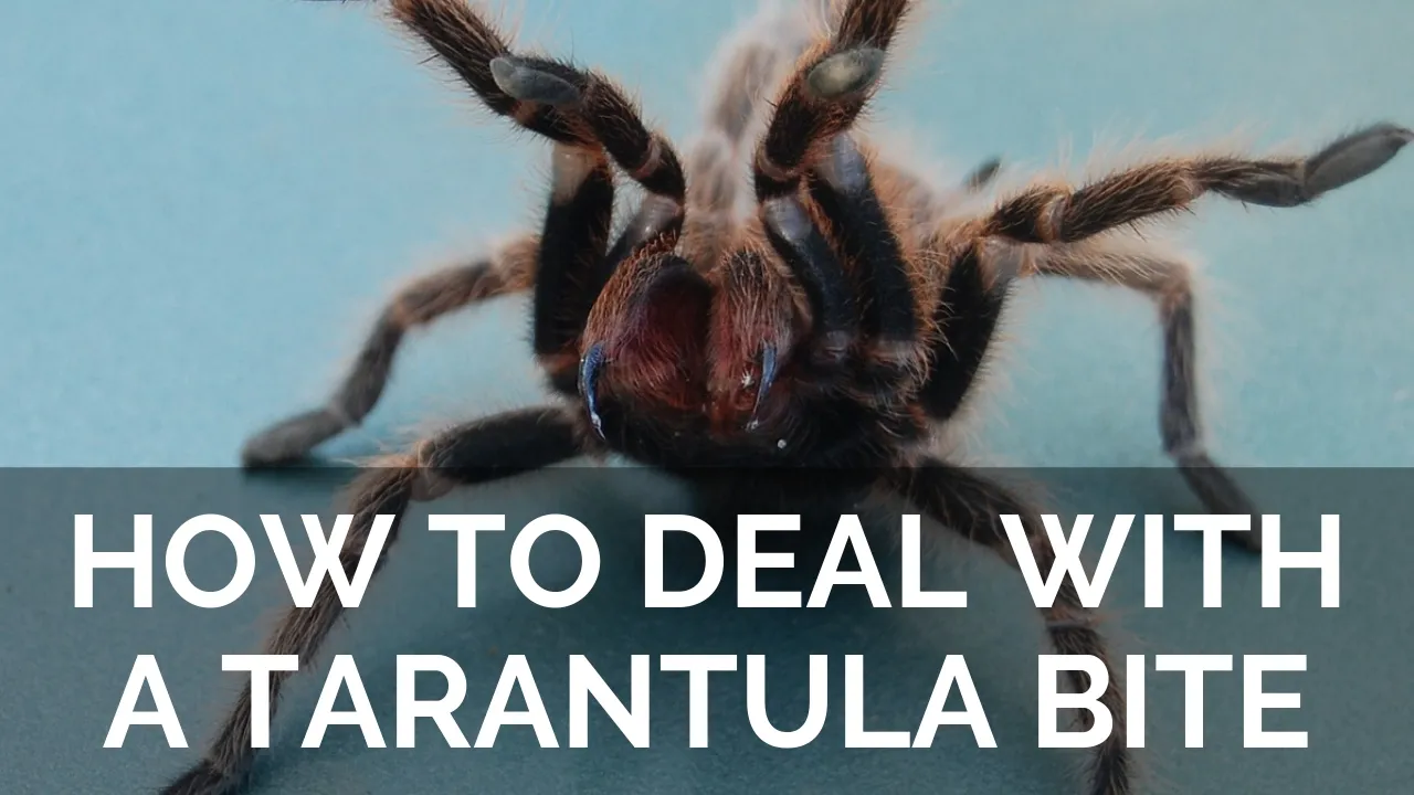 17197 cold compress tarantula bite